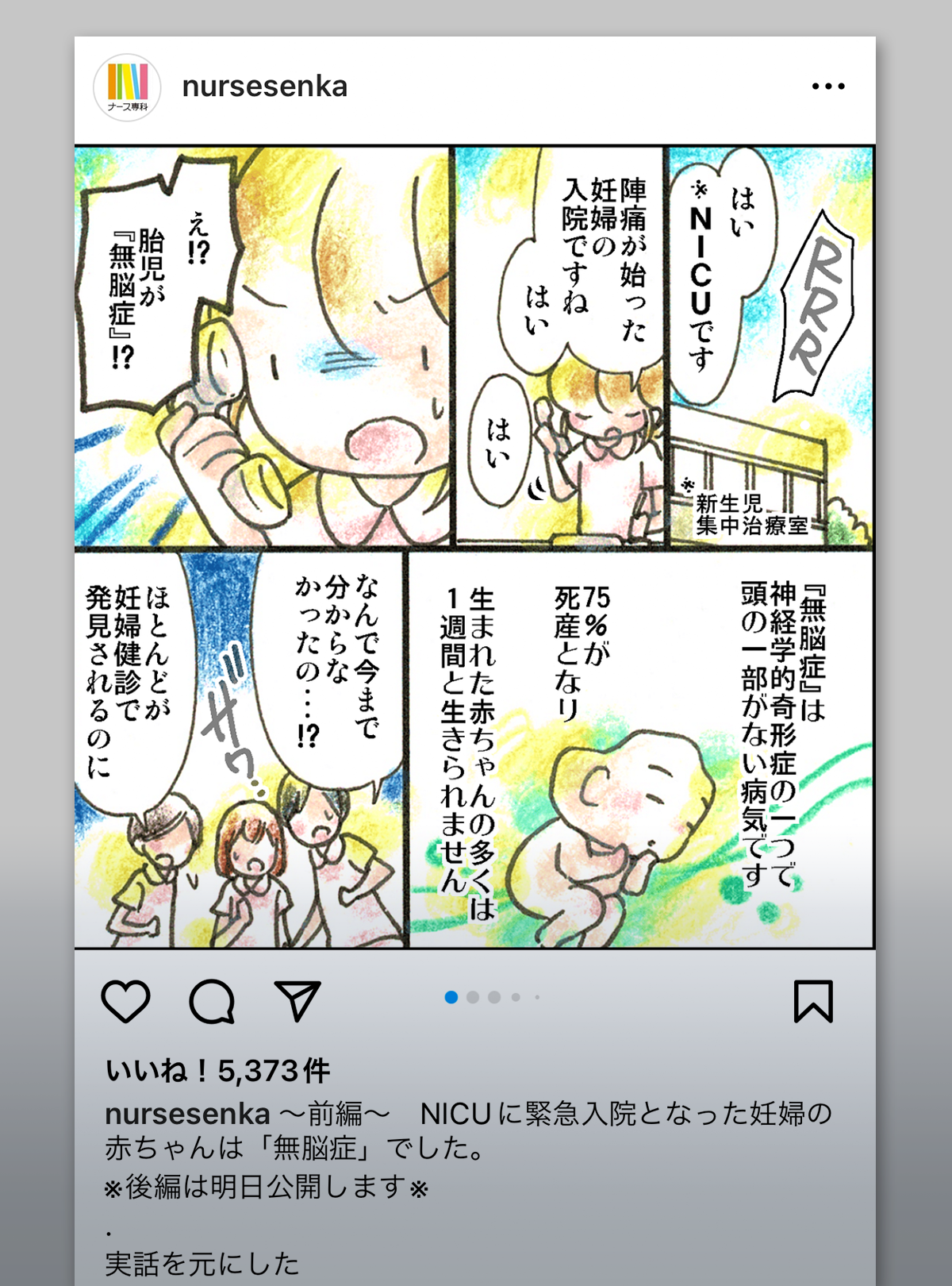 無脳症のベビーとの関わり|ナース専科インスタグラムより
