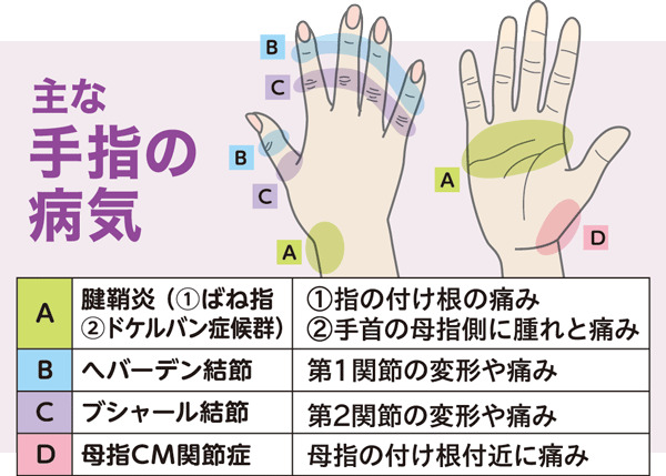 手指の不調も更年期症状の一つ