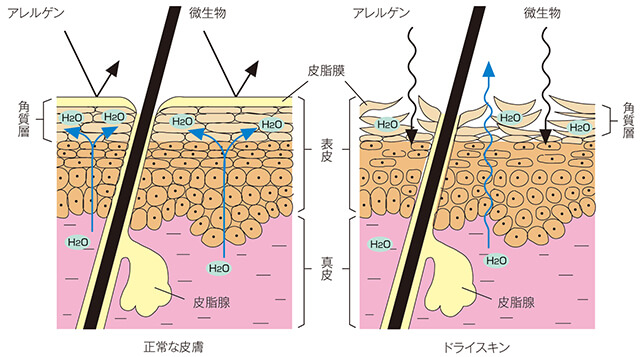 正常な皮膚とドライスキンのバリア機能