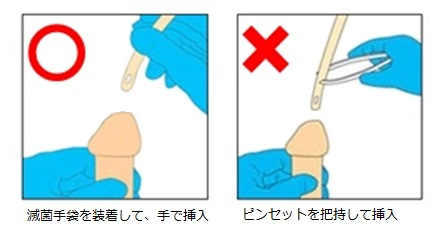 挿入手技の変更