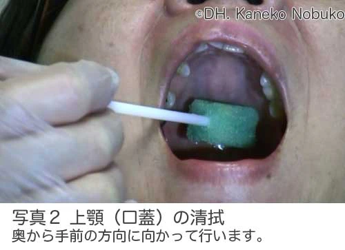上顎の清拭写真