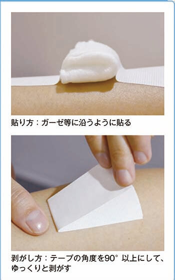 医療粘着テープの貼り方、剥がし方手順