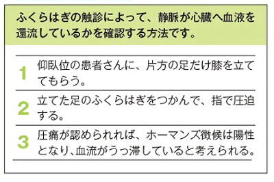ホーマンズ徴候