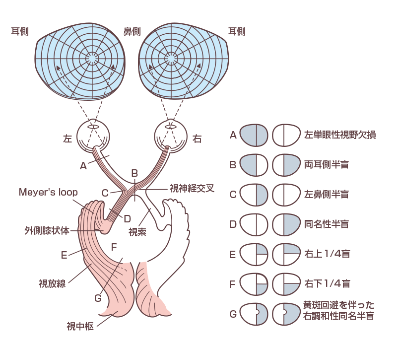 半盲とは