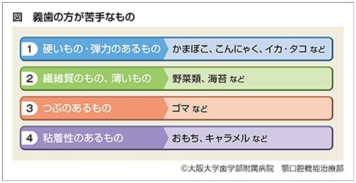 義歯の方が苦手なもの、説明図