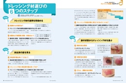 ナース専科2015年7月号『褥瘡ケア あなたの疑問を認定看護師がズバリ解決!』内容③