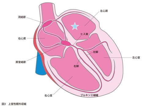 上室性期外収縮説明図
