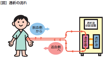 透析の流れ