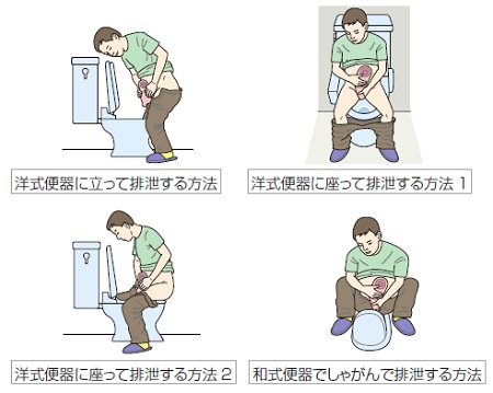 便器での排泄物を捨てる姿勢の例、イラスト