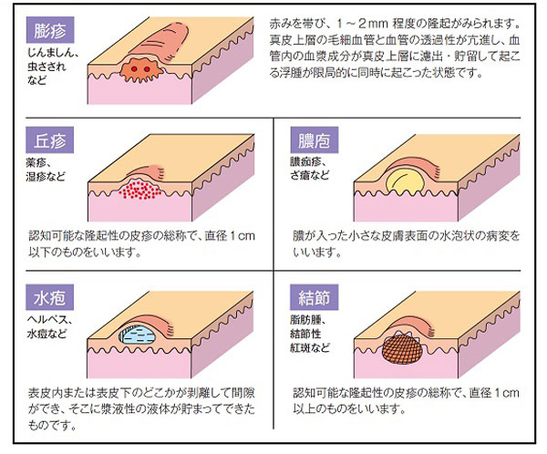 皮膚の局所状態の見方