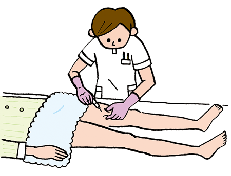 大腿部内内側への皮下注射