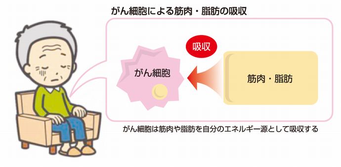 がん悪液質説明イラスト