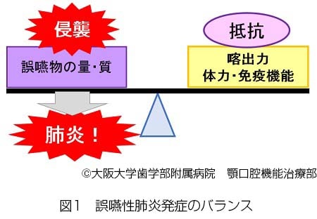 誤嚥性肺炎発症のバランス説明図