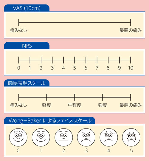 痛みの強さ