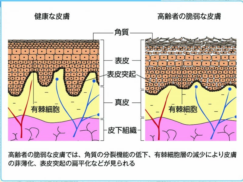 皮膚の構造説明図