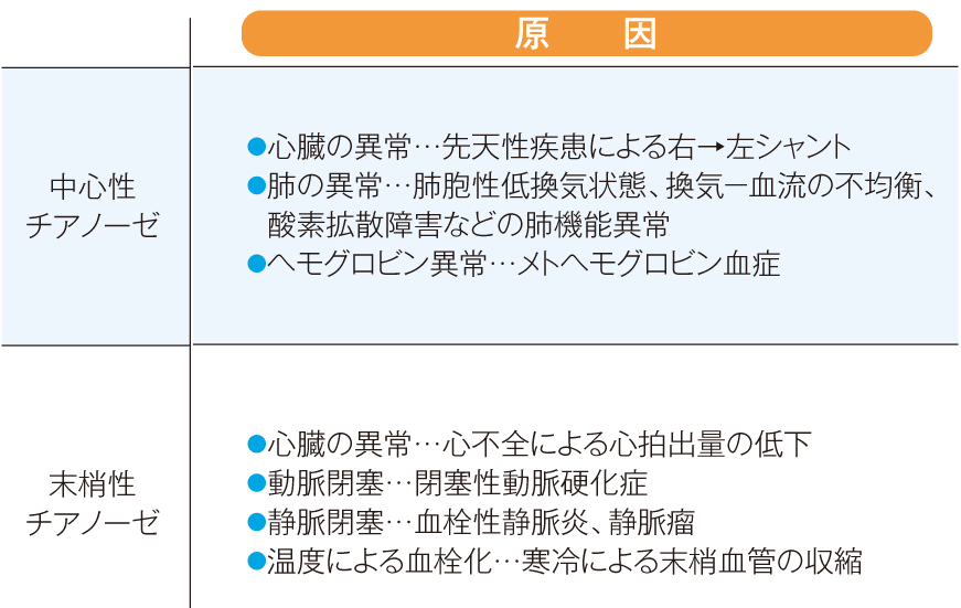 チアノーゼの原因一覧