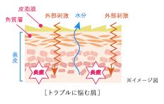 square_234503_babyskin2