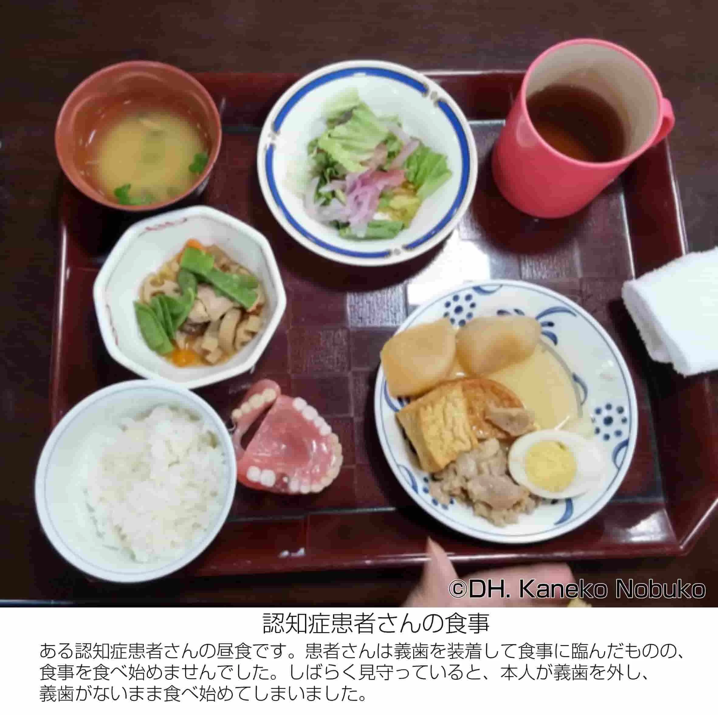 認知症患者さんの食事の写真