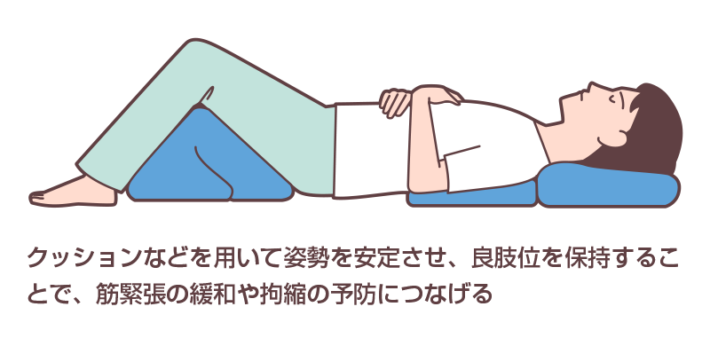 適切なポジショニングの実施