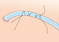 ドレーンの固定法説明図