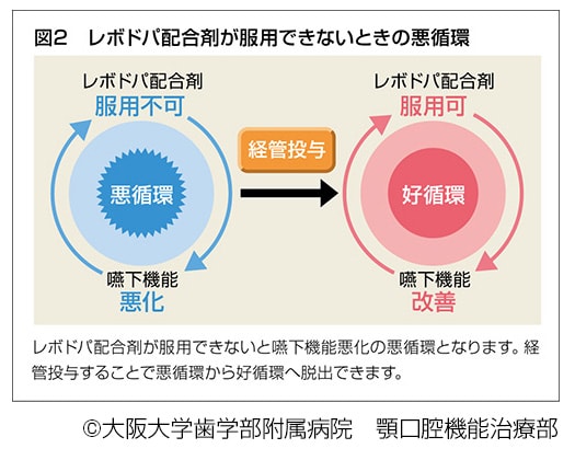 レボドパ配合剤が服用できないときの悪循環、説明図
