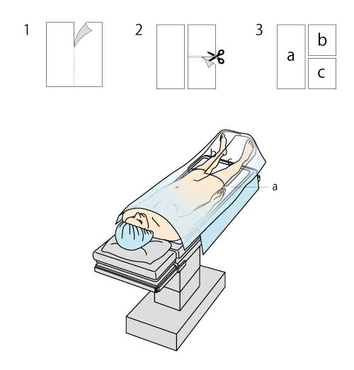 血管造影室での使用例