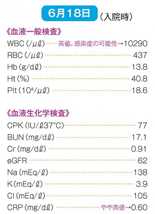 検査値の推移(6月18日)