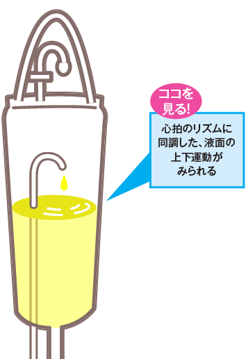 拍動説明図