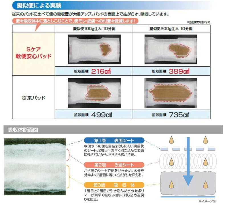病院全体の課題解決に向けて「軟便パッド」の導入へ