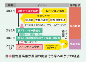 慢性肝疾患が原因の皮膚そう痒へのケアの過程説明図