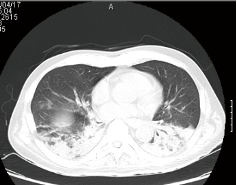 この症例をどう考えるか
