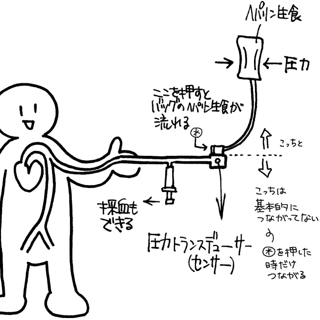 動脈ラインを確保する方法