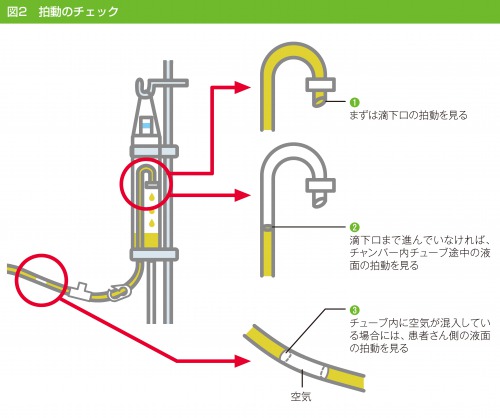 拍動のチェック