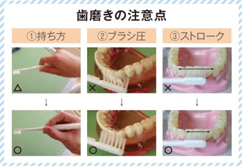 歯磨きの注意点