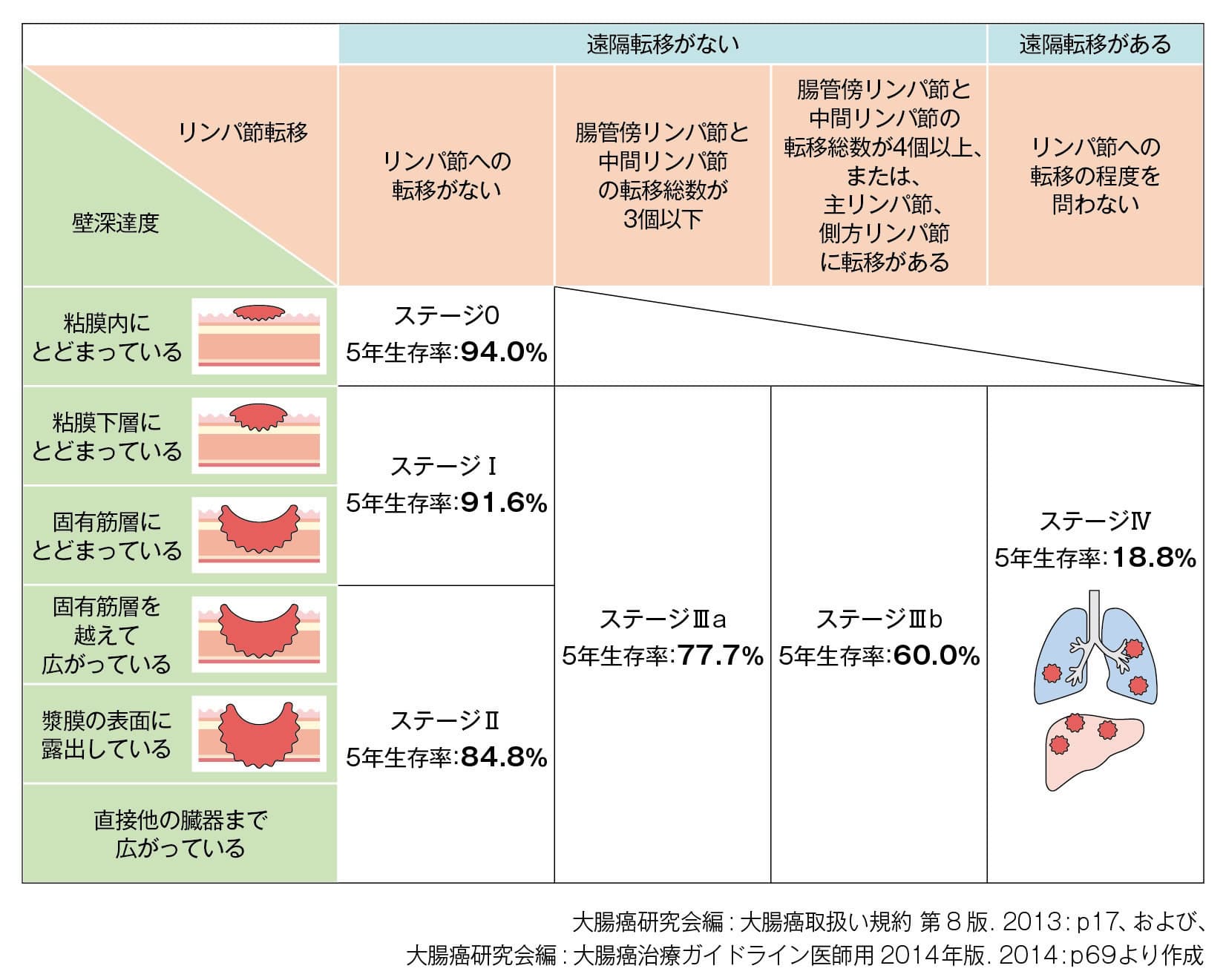 大腸がんのステージ分類と5年生存率