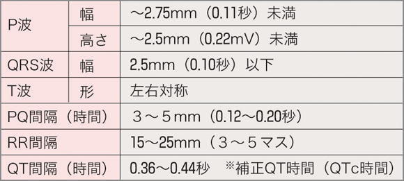 心電図判読のポイントまとめ表