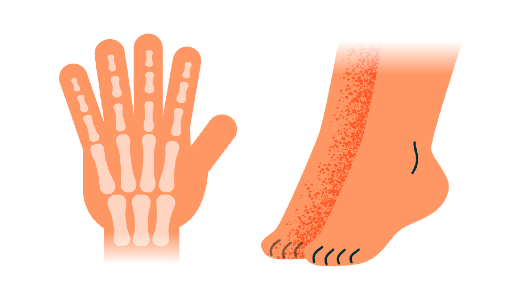 スキマ時間の手足ツボ押しで腰痛改善＆血流UP