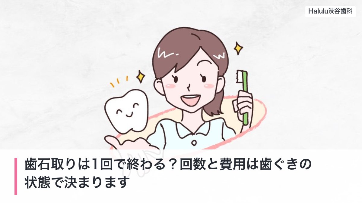 歯石取りは1回で終わる？回数と費用は歯ぐきの状態で決まります