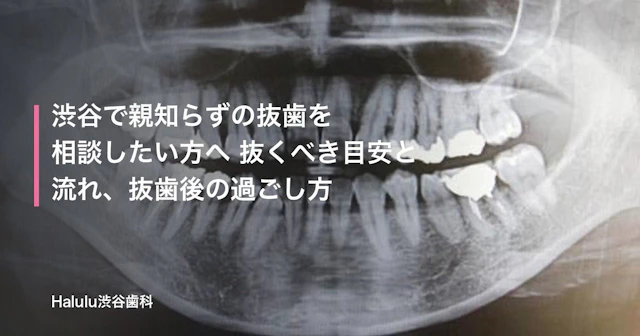 渋谷で親知らずの抜歯を相談したい方へ 抜くべき目安と流れ、抜歯後の過ごし方