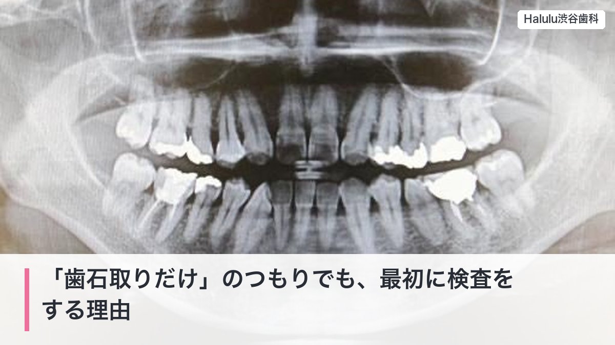 「歯石取りだけ」のつもりでも、最初に検査をする理由