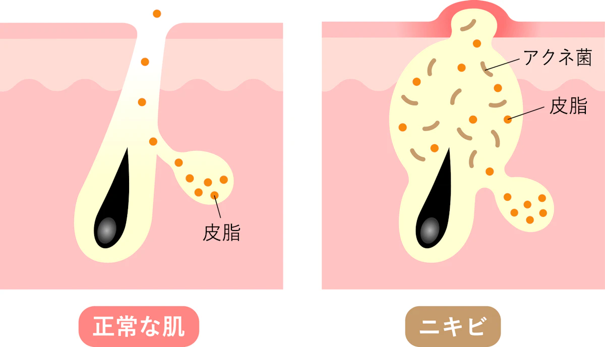毛穴状態比較