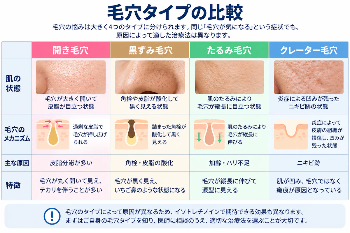 毛穴タイプ比較表