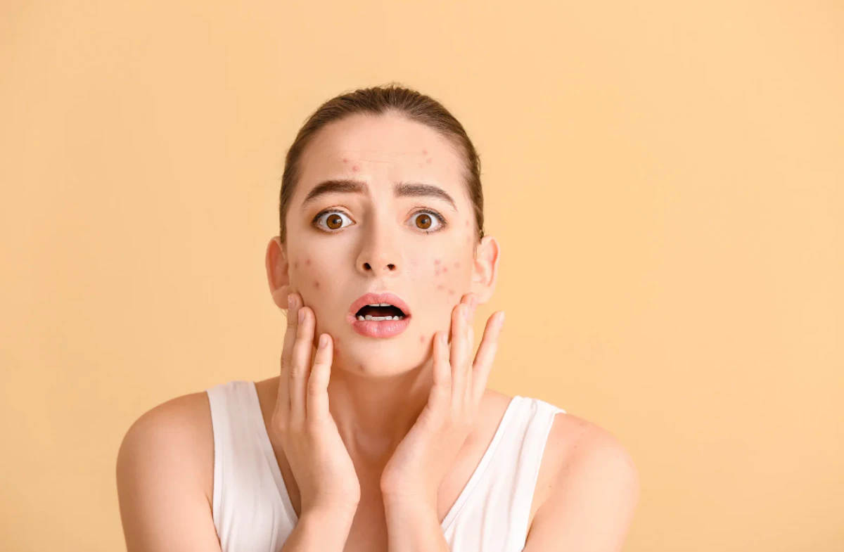 イソトレチノイン10mgと20mgはどっちがいい?違い・効果・副作用を比較解説
