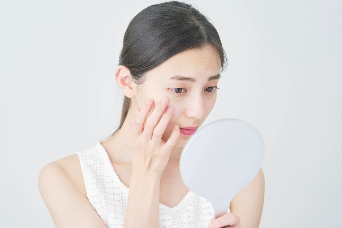 乾燥肌なのにニキビができる原因と正しい対策|皮膚科医が解説