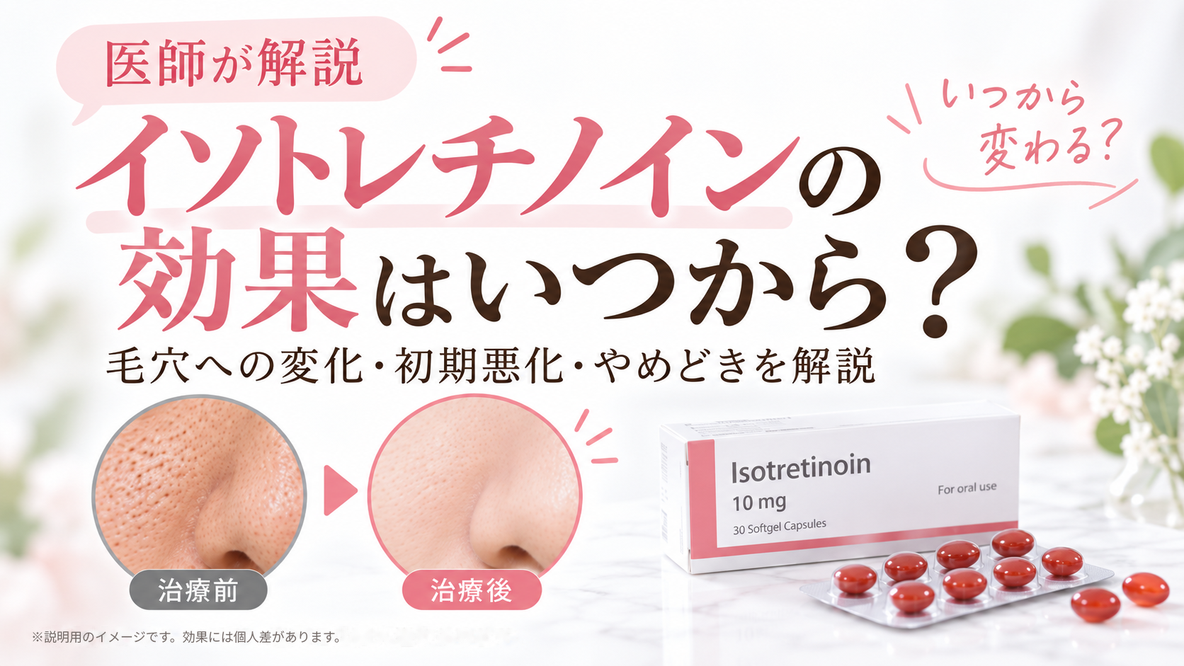 イソトレチノインの効果はいつから？毛穴への変化・初期悪化・やめどきを医師が解説