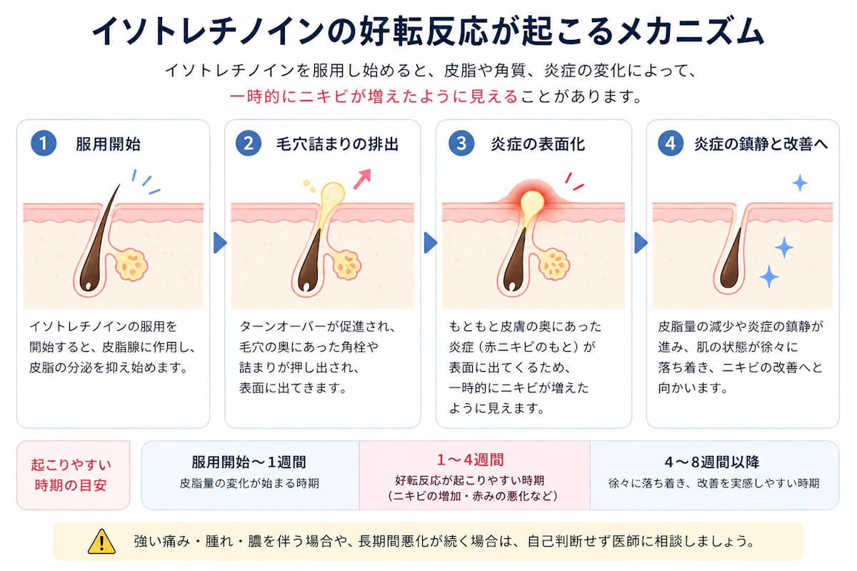 イソトレチノインの好転反応が起こるメカニズムを示した図