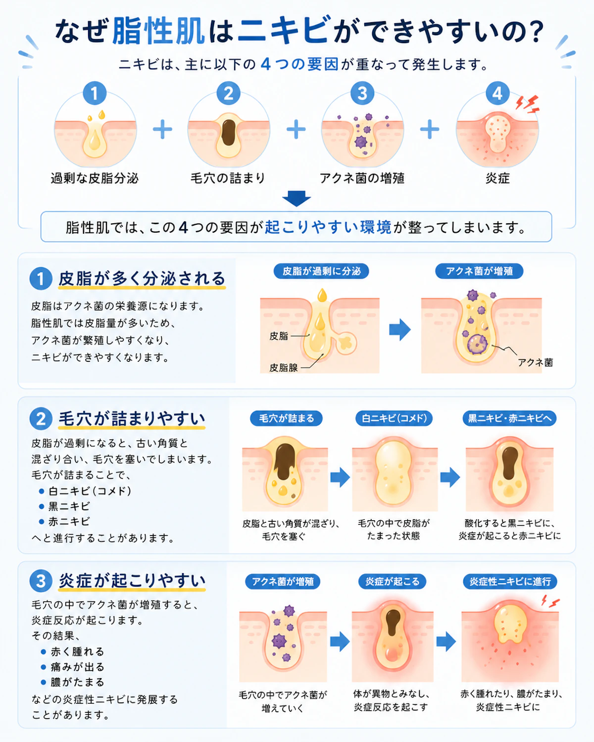 脂性肌の特徴