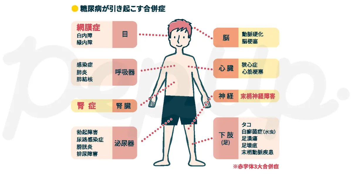 糖尿病が引き起こす合併症を示した人体図
