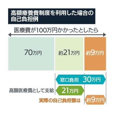 高額療養費制度を利用した場合の自己負担例