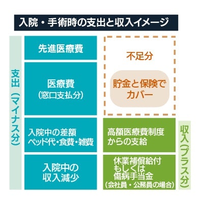 入院・手術時の支出と収入のイメージ